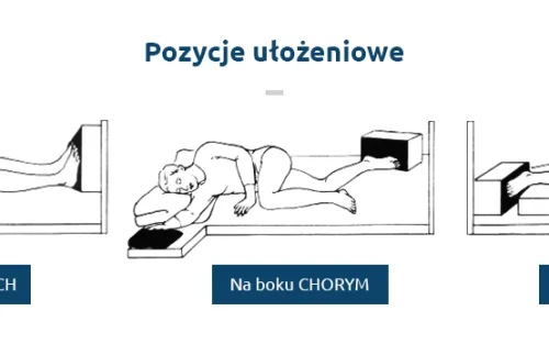Spastyczność